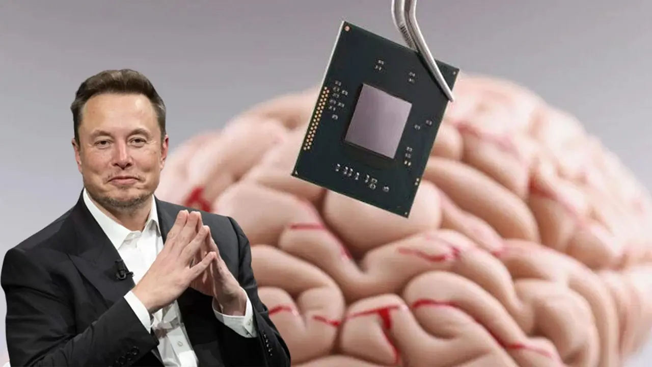 Proyek Neuralink Sukses Tanam Chip ke Otak, Elon Musk Mau Ciptakan Manusia Super?