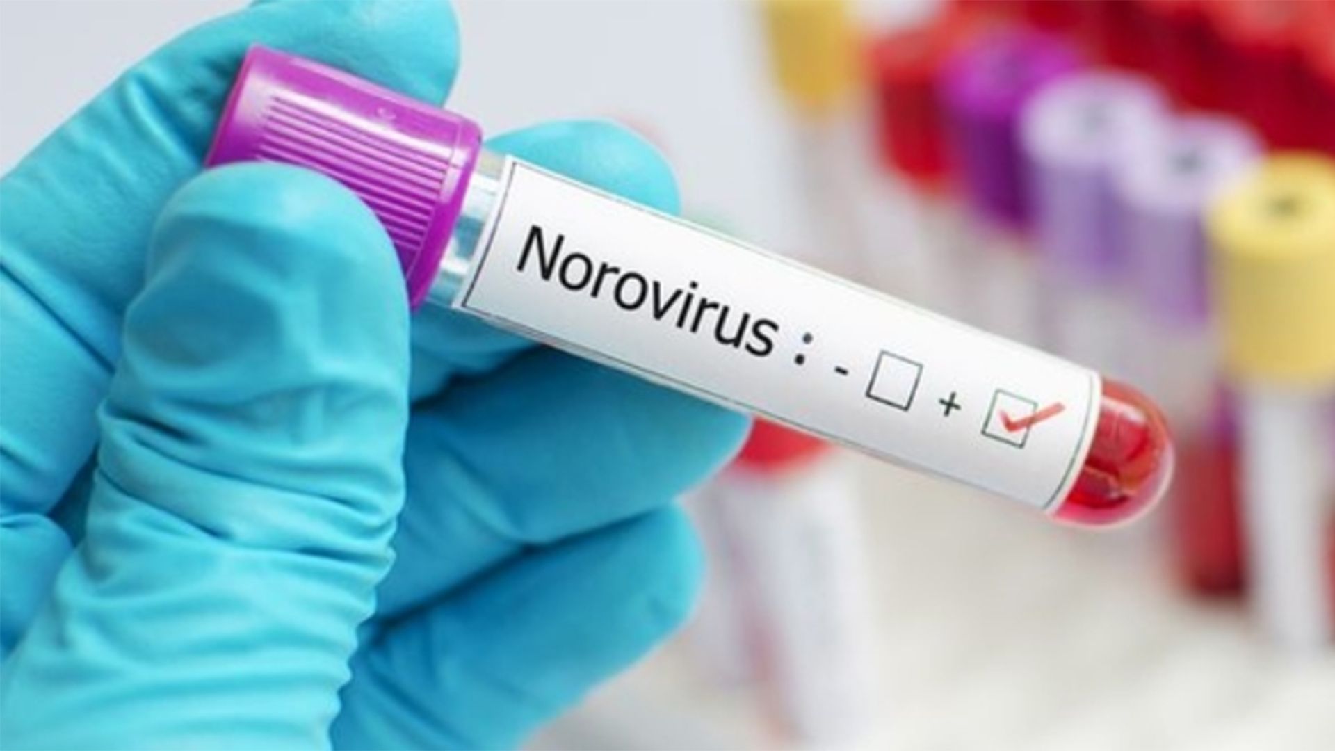 NoroVirus