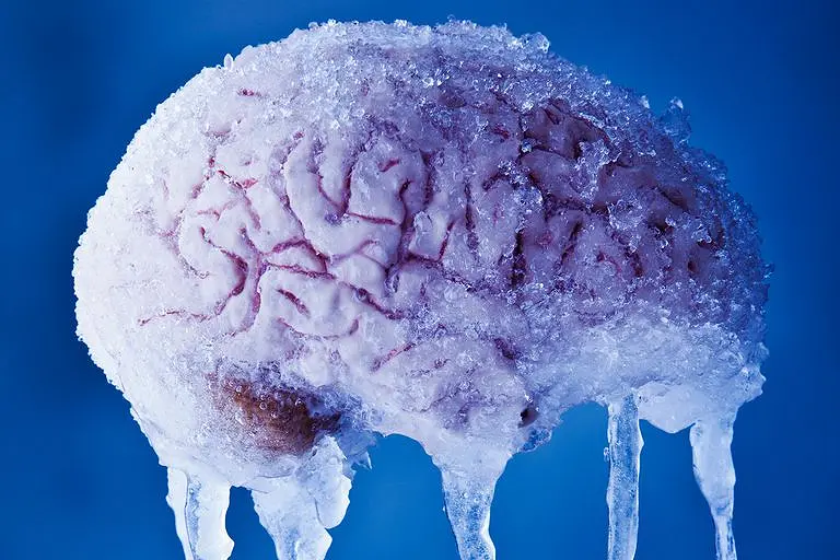 brain freeze