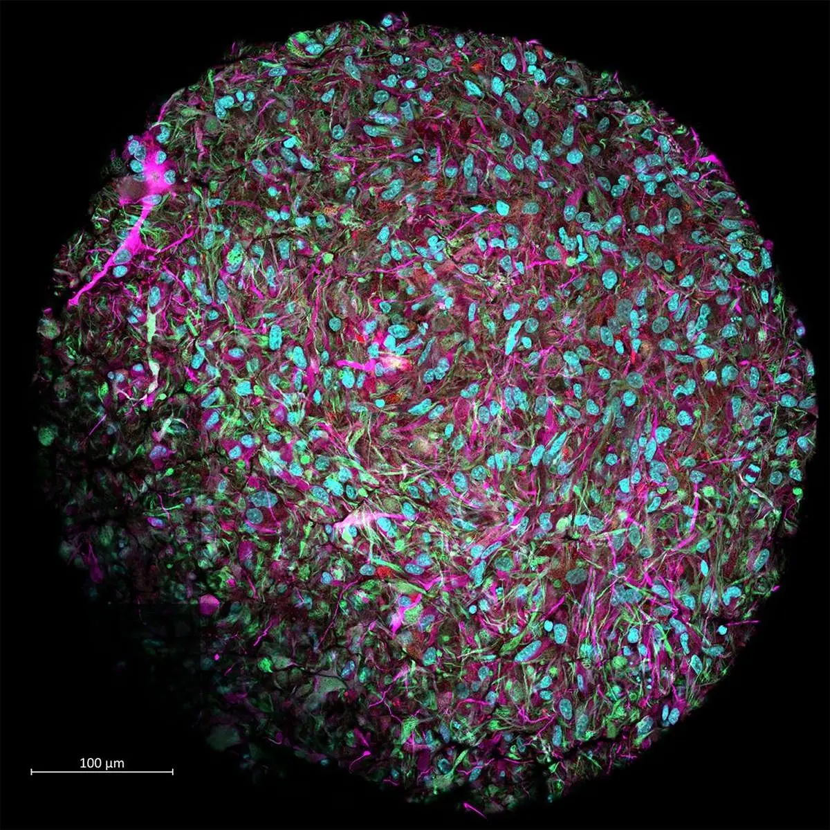 Organoid Intelligence OI