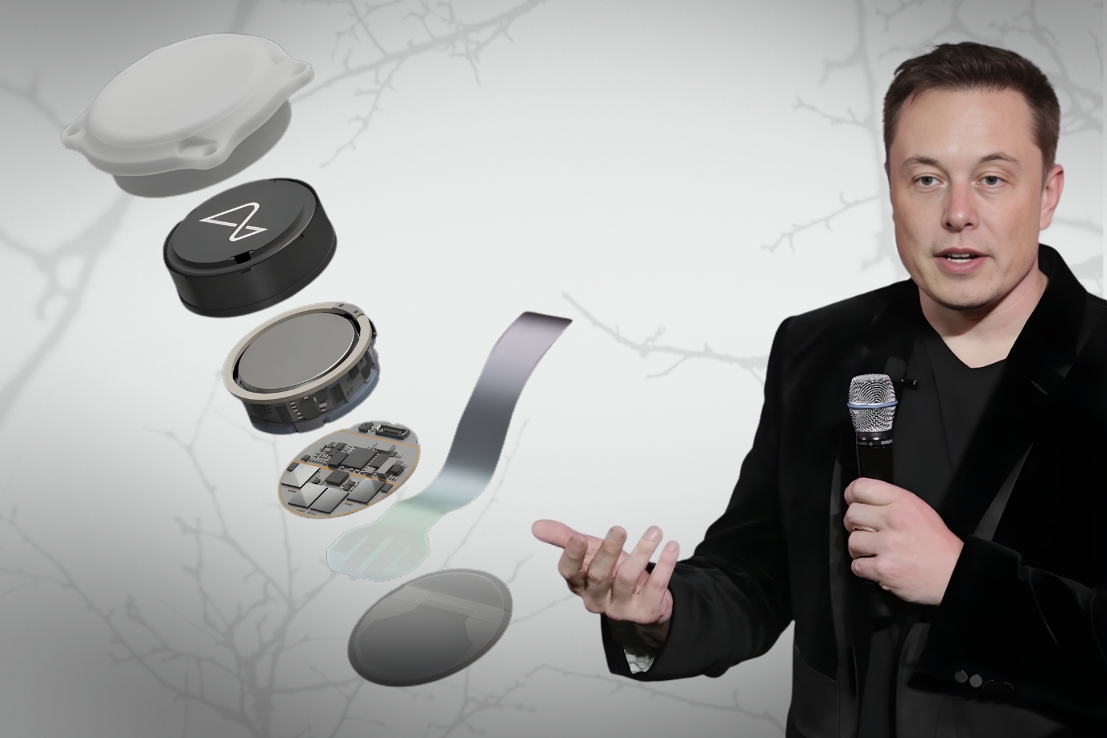 Neuralink 2026, Elon Musk brain chip, produksi massal Neuralink, teknologi BCI, implan otak manusia, robot bedah Neuralink, masa depan AI dan manusia