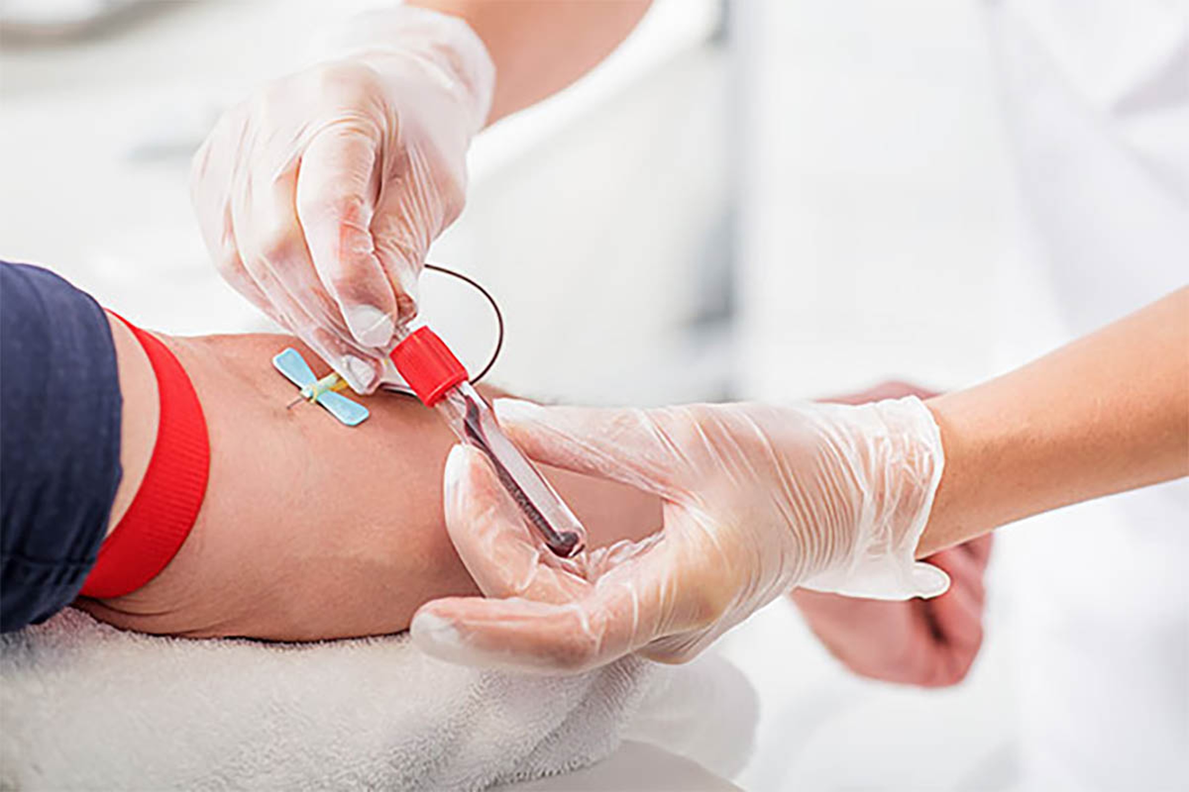 Tes darah prediksi umur manusia panjang, tes darah piRNA penuaan, Virginia Byers Kraus Sisi Ma, prediksi angka harapan hidup.