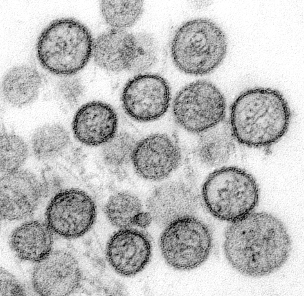 Tercatat 4 kasus hantavirus di Jakarta. Peneliti BRIN jelaskan sumber penularan dari tikus dan fakta penularan antarmanusia yang sangat jarang terjadi.
